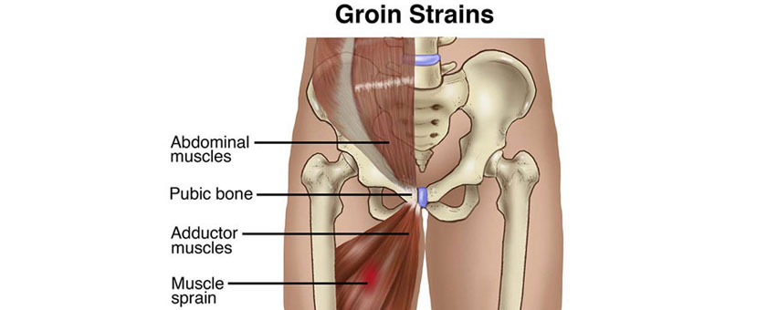 Groin Injuries