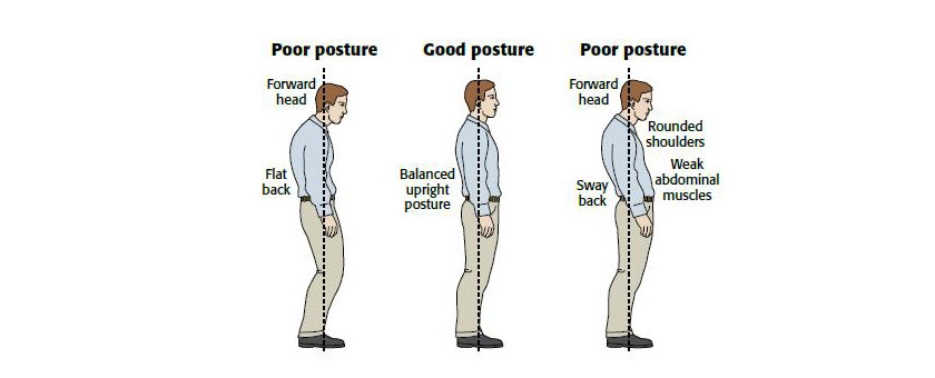 Poor Posture Treatment - California Chiropractic Center - Dubai, UAE